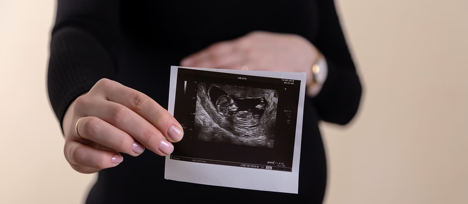 Obstetrică-Ginecologie - Clinica Dr. Stoica